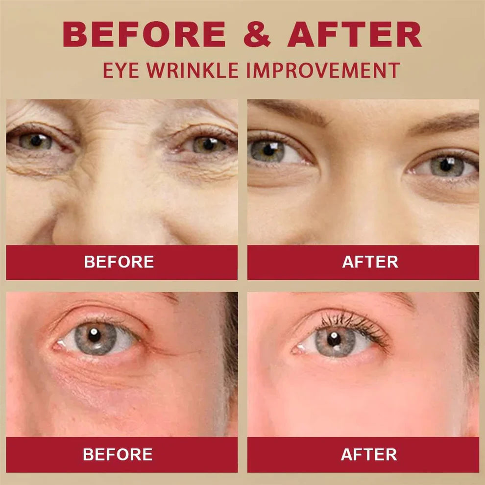 K-SECRET SEOUL 1988 Retinal Eye Cream | Dark Circle, Fine Lines, Wrinkles